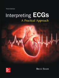 Interpreting ECGs: A Practical Approach 3rd edition | 9781260017243 ...