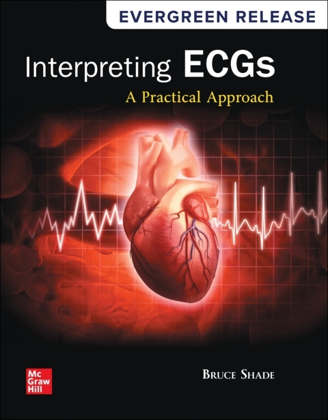 Cover image for book Fast and Easy ECGs - A Self Paced Learning Program