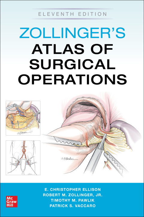 Cover image for book Zollinger's Atlas of Surgical Operations