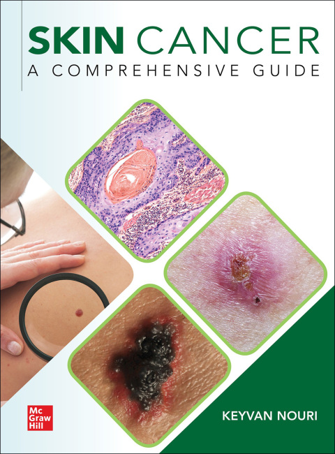 Cover image for book Skin Cancer: A Comprehensive Guide
