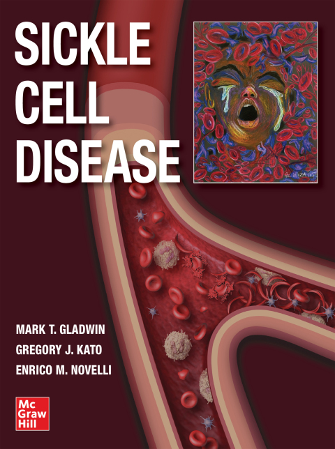 Cover image for book Sickle Cell Disease