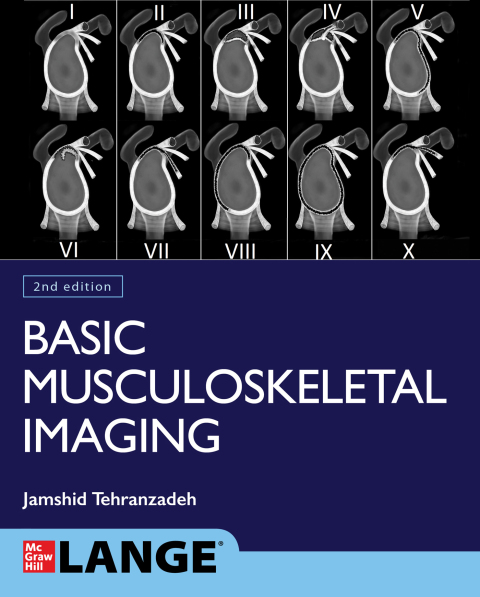 Cover image for book Basic Musculoskeletal Imaging, Second Edition