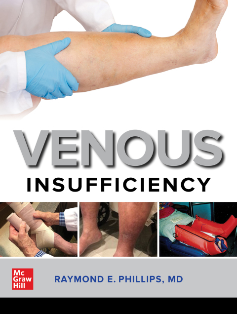 Cover image for book Venous Insufficiency