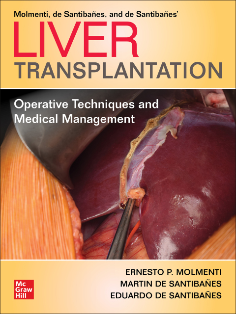 Cover image for book Liver Transplantation: Operative Techniques and Medical Management