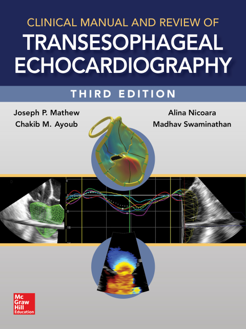 Cover image for book Clinical Manual and Review of Transesophageal Echocardiography