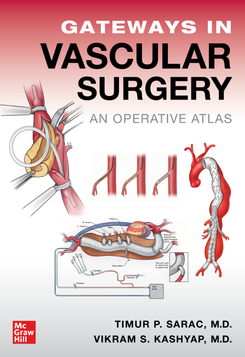 Cover image for book Gateways in Vascular Surgery: An Operative Atlas