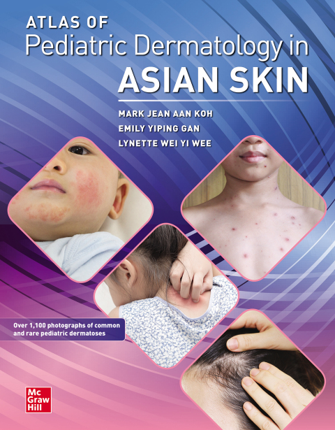 Cover image for book Atlas of Pediatric Dermatology in Asian Skin