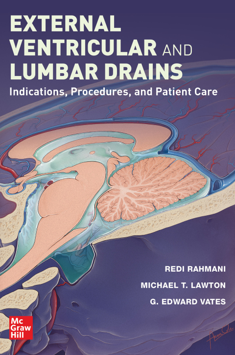 Cover image for book External Ventricular and Lumbar Drains: Indications, Procedures, and Patient Care