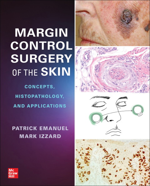 Cover image for book Margin Control Surgery of the Skin: Concepts, Histopathology, and Applications