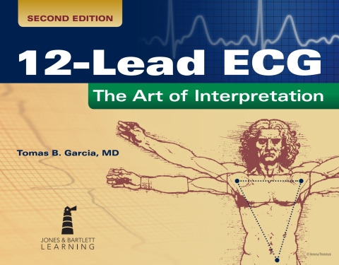 12 Lead Ecg Art Of Interpretation