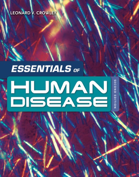 Cover image for book Essentials of Human Disease