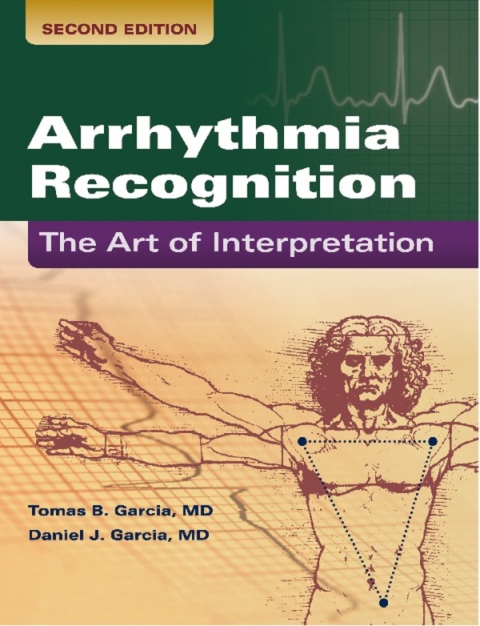 Cover image for book Arrhythmia Recognition: The Art of Interpretation