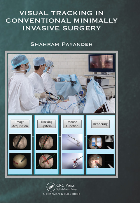 Cover image for book Visual Tracking in Conventional Minimally Invasive Surgery