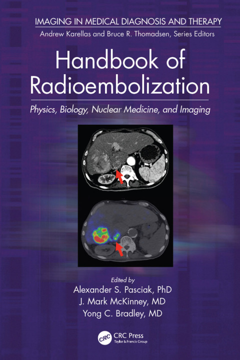 Handbook of Radioembolization 
