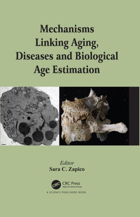 Cover image for book Mechanisms Linking Aging, Diseases and Biological Age Estimation