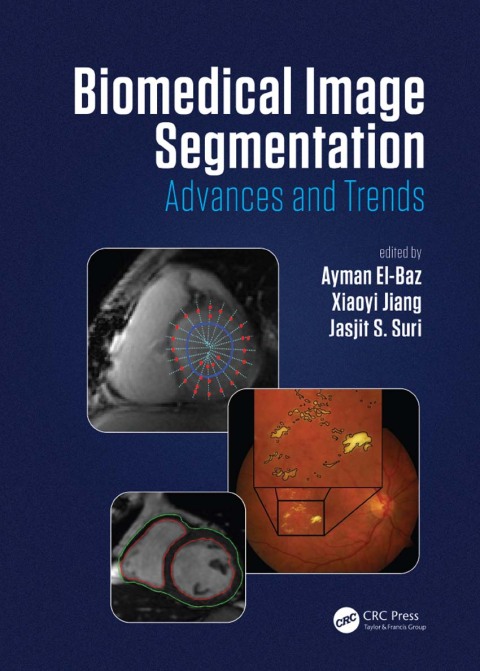 Biomedical Image Segmentation 