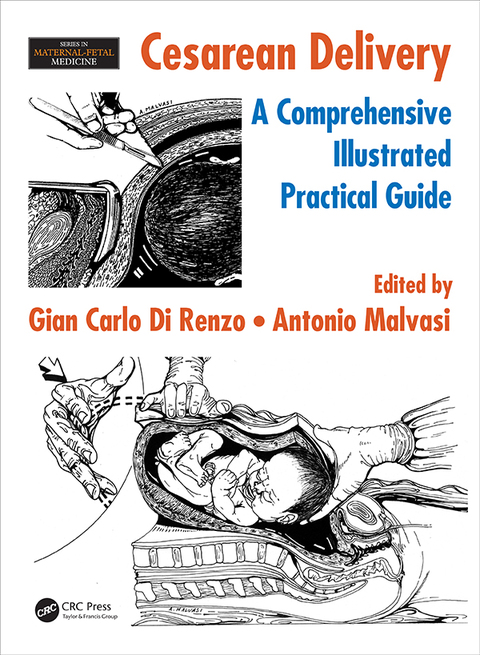 Cover image for book Cesarean Delivery