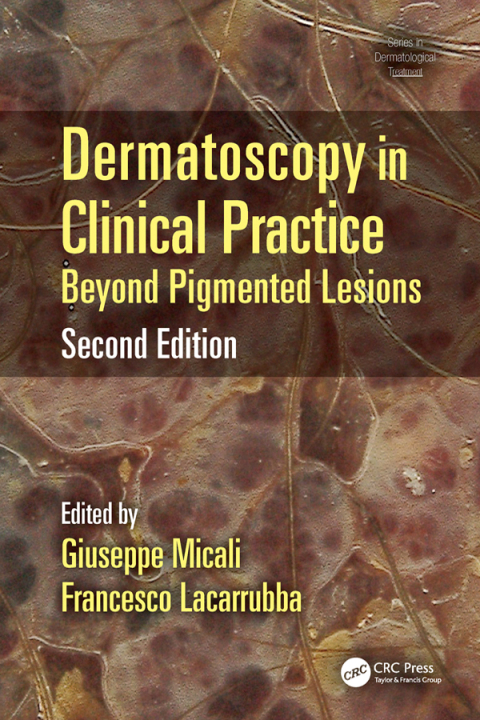 Cover image for book Dermatoscopy in Clinical Practice