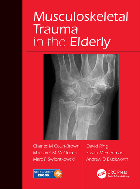 Cover image for book Musculoskeletal Trauma in the Elderly
