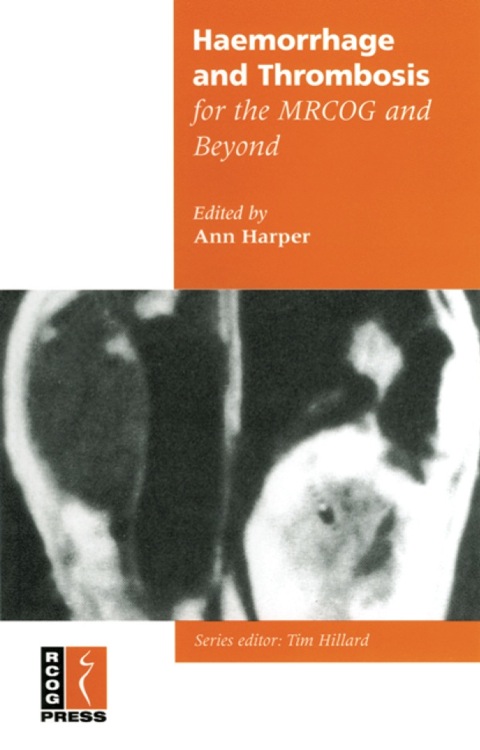 Cover image for book Haemorrhage and Thrombosis for the MRCOG and Beyond