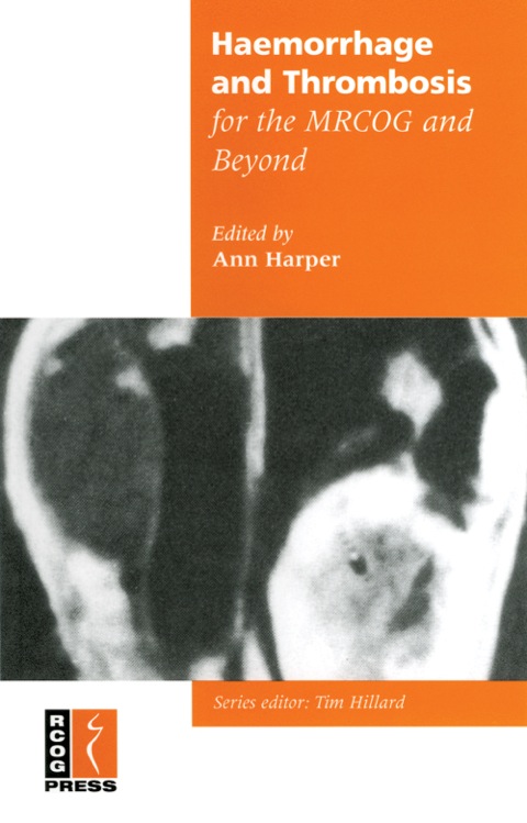 Cover image for book Haemorrhage and Thrombosis for the MRCOG and Beyond