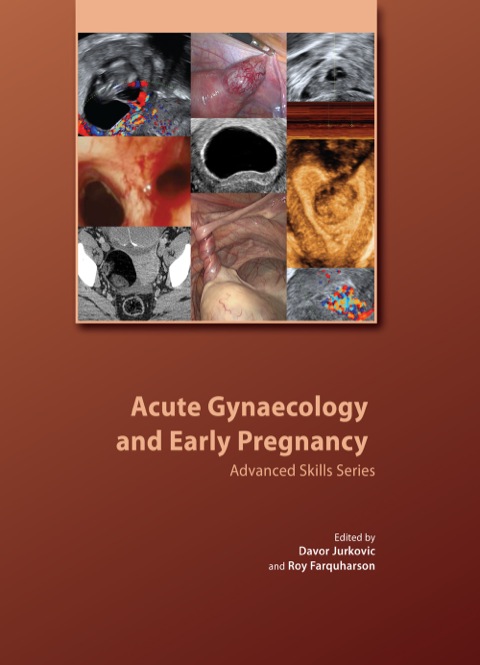 Cover image for book Acute Gynaecology and Early Pregnancy