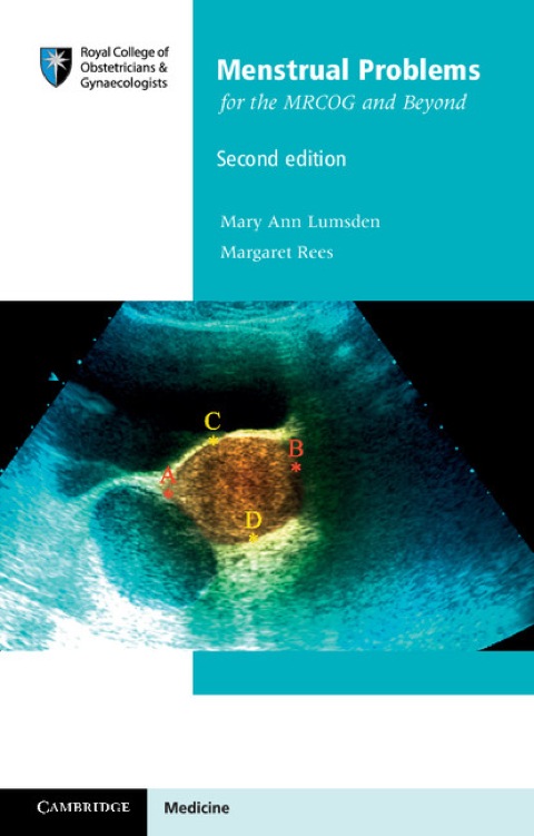 Cover image for book Menstrual Problems for the MRCOG and Beyond