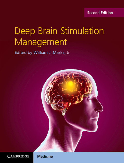 Cover image for book Deep Brain Stimulation Management