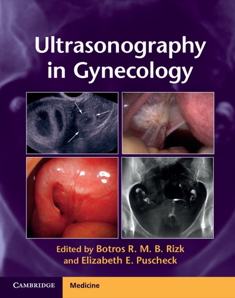 Cover image for book Ultrasonography in Gynecology