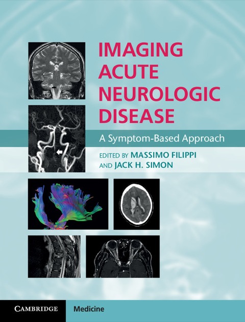 Cover image for book Imaging Acute Neurologic Disease