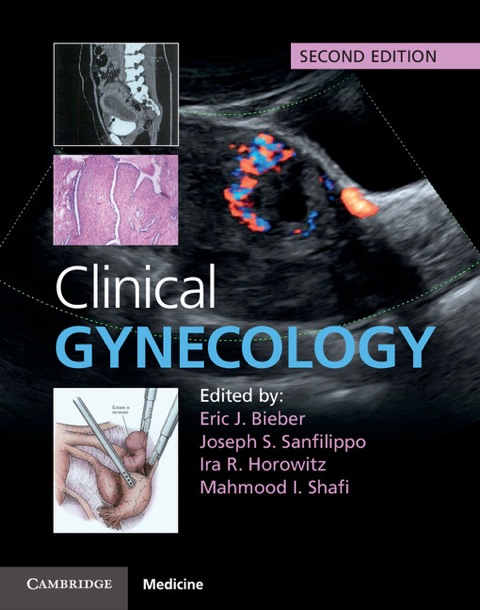 Cover image for book Clinical Gynecology