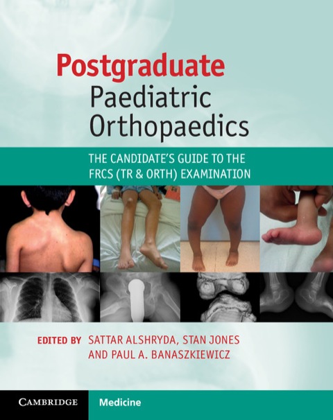 Cover image for book Postgraduate Paediatric Orthopaedics