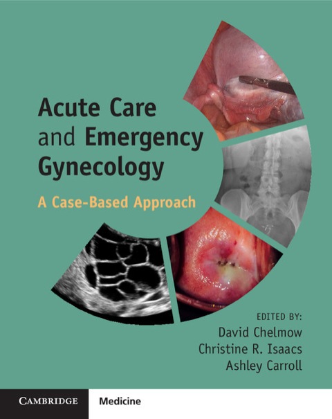 Cover image for book Acute Care and Emergency Gynecology