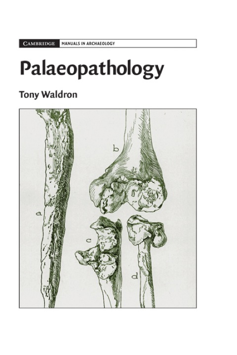 Cover image for book Palaeopathology