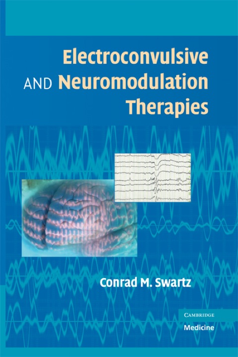 Cover image for book Electroconvulsive and Neuromodulation Therapies