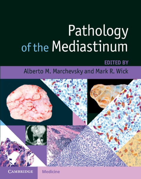 Cover image for book Pathology of the Mediastinum
