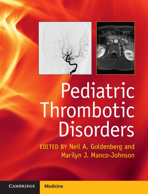 Cover image for book Pediatric Thrombotic Disorders