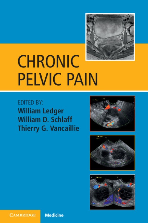 Chronic Pelvic Pain 