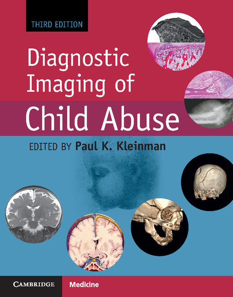 Cover image for book Diagnostic Imaging of Child Abuse
