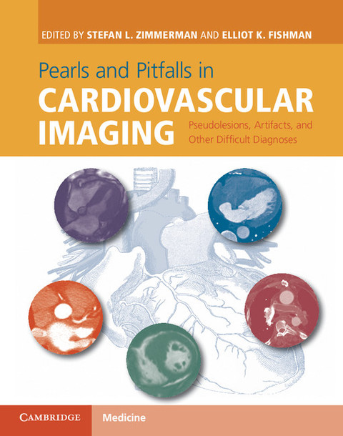 Cover image for book Pearls and Pitfalls in Cardiovascular Imaging