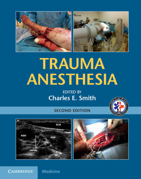 Cover image for book Trauma Anesthesia
