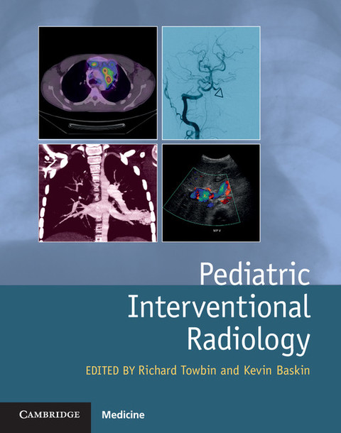 Cover image for book Pediatric Interventional Radiology