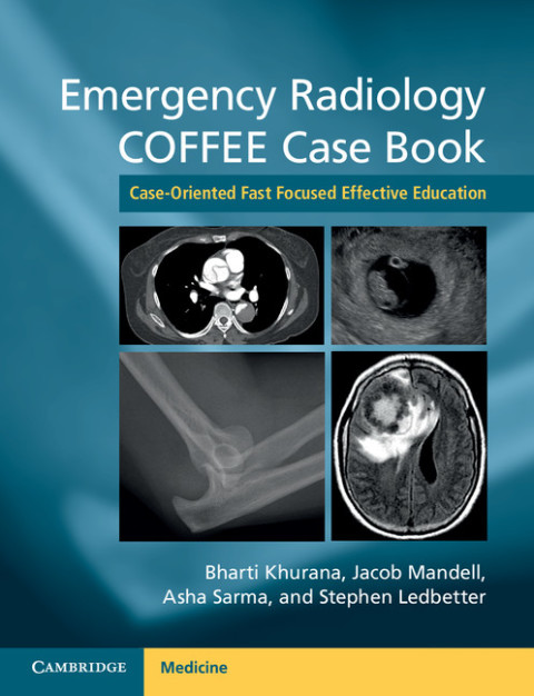 Cover image for book Emergency Radiology COFFEE Case Book