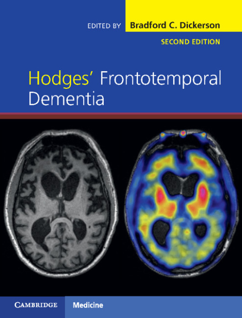 Cover image for book Hodges' Frontotemporal Dementia