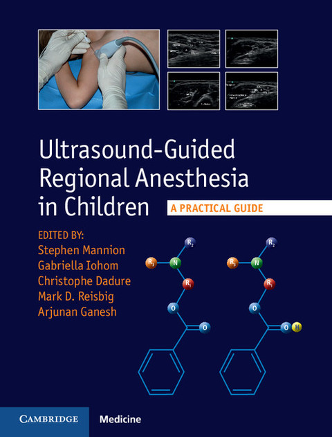 Cover image for book Ultrasound-Guided Regional Anesthesia in Children