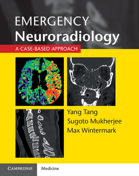 Cover image for book Emergency Neuroradiology