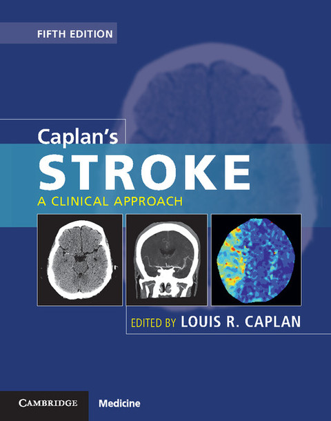 Caplan's Stroke 