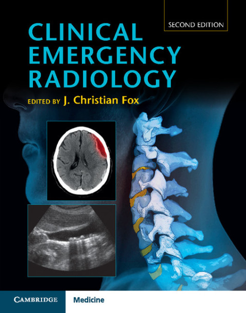 Cover image for book Clinical Emergency Radiology