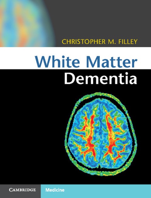 Cover image for book White Matter Dementia