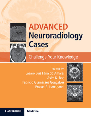 Advanced Neuroradiology Cases